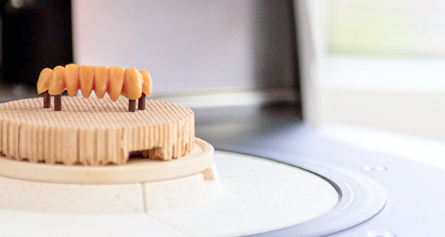 Zahntechnische Modelle im Dentallabor